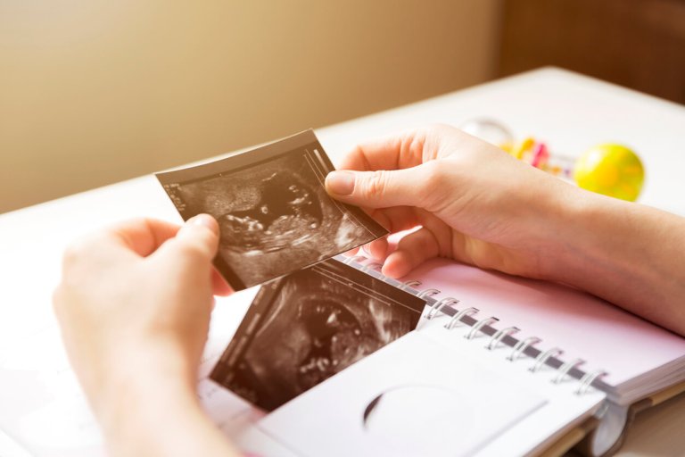 a baby memory book with baby ultrasound pictures